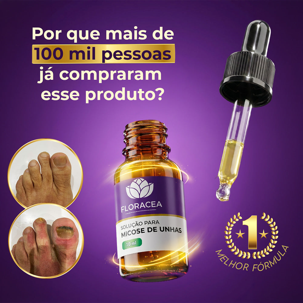 Solução de Micose 10ml